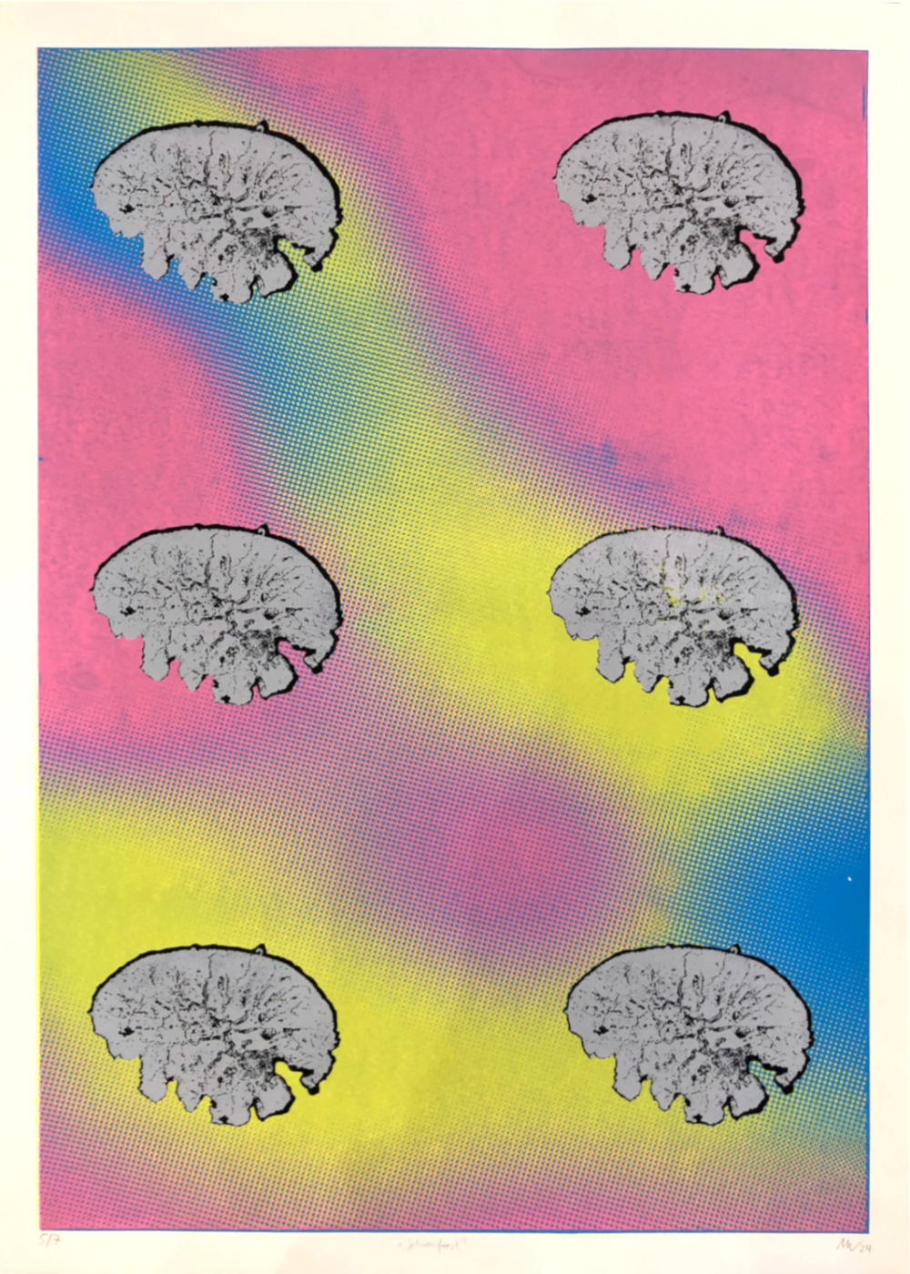 Gehirnfrost – Michael Wismar